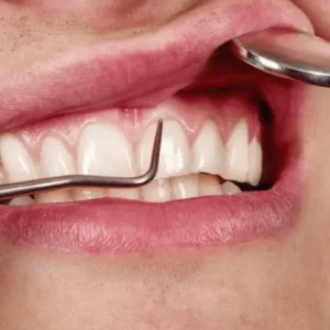 طرق حديثة في علاج التهاب اللثة